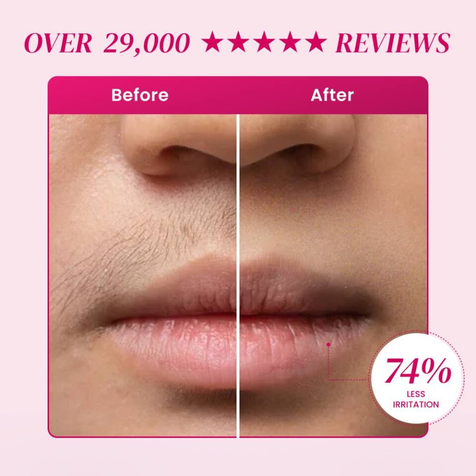 EpiBella image
